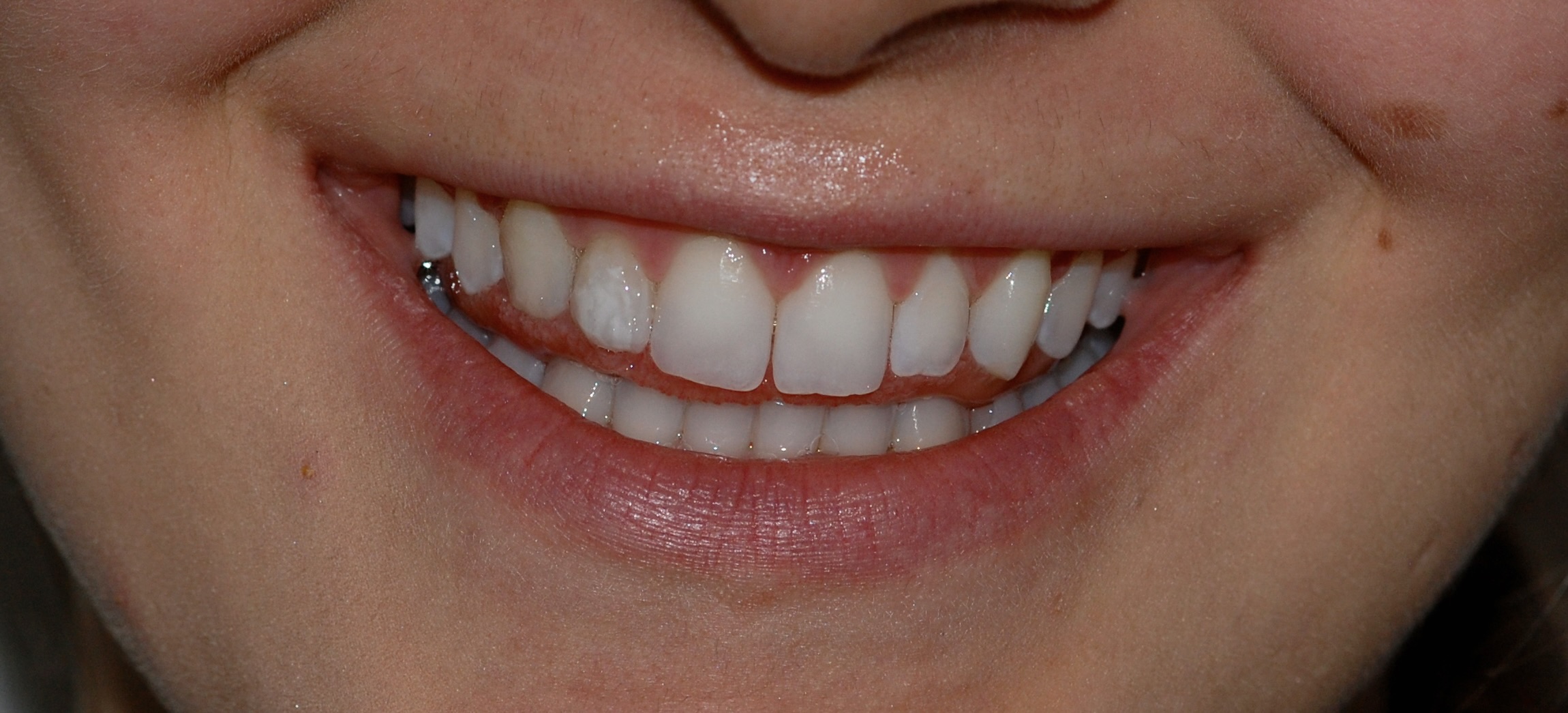Odontoiatria Restaurativa ed Estetica Dentale